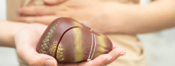 Exercise Can Reverse Fatty Liver: A Gastroenterologist’s Guide to MASLD